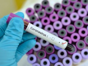 coronavirus brusciano