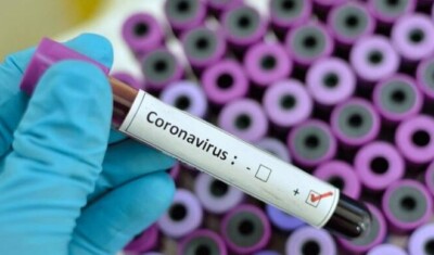 Coronavirus