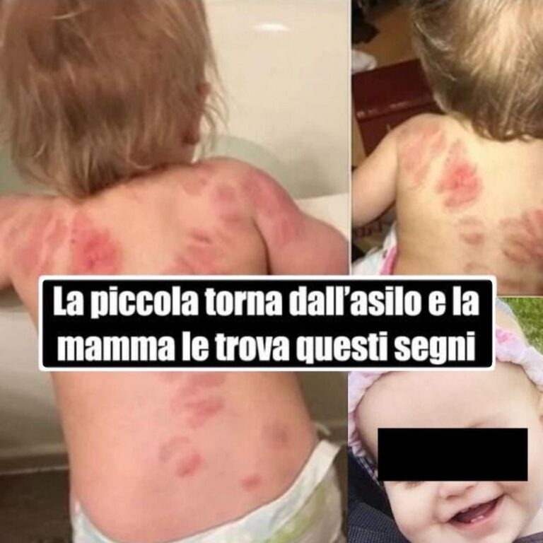 bamba morsa all'asilo