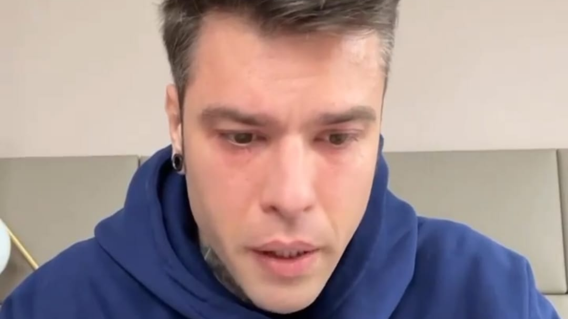 Fedez malato: l'annuncio del cantante su Instagram - IL VIDEO - Napoli ZON