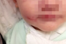 Orrore in Pianura, bambino preso a pugni e a morsi dal padre, napoli bimbo 18 mesi ferito