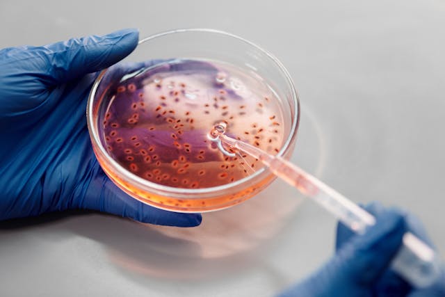 West Nile – Oggi s’è registrato il primo caso neuroinvasivo in Italia west Nile primo caso neuroinvasivo in Italia